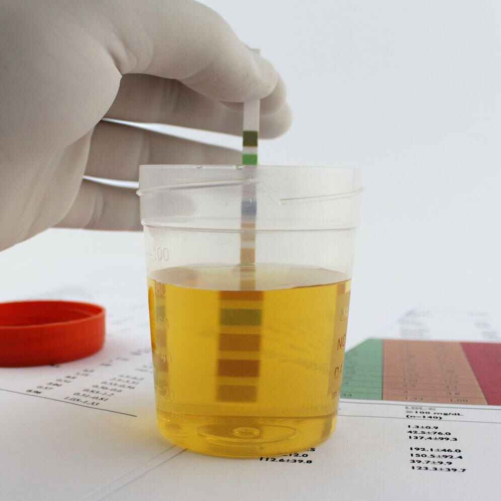 Kidney Hospital in Vijayawada Central Karma Ayurveda Hospital