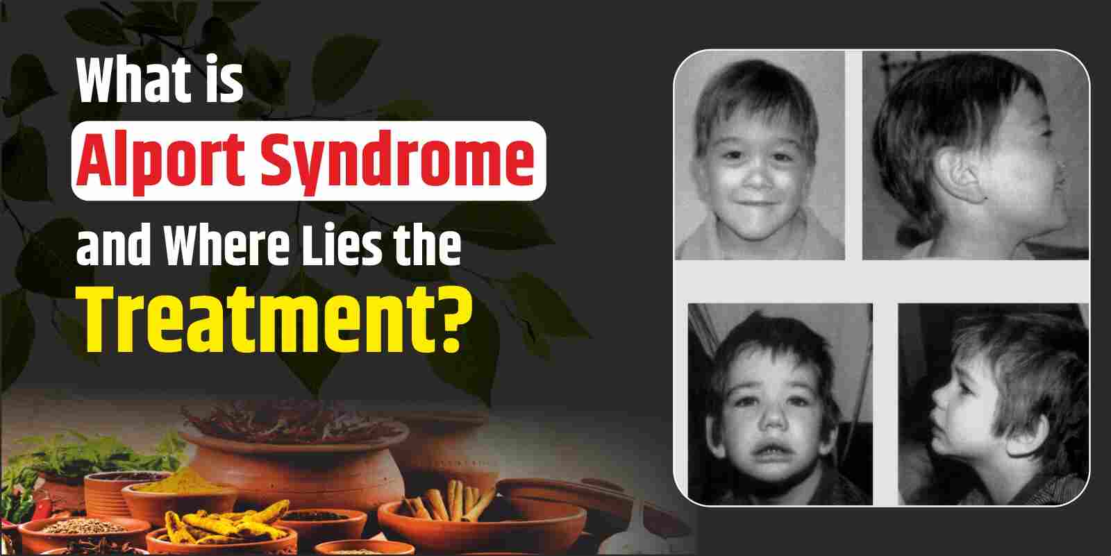 What Is Alport Syndrome? Causes, Symptoms & Treatment