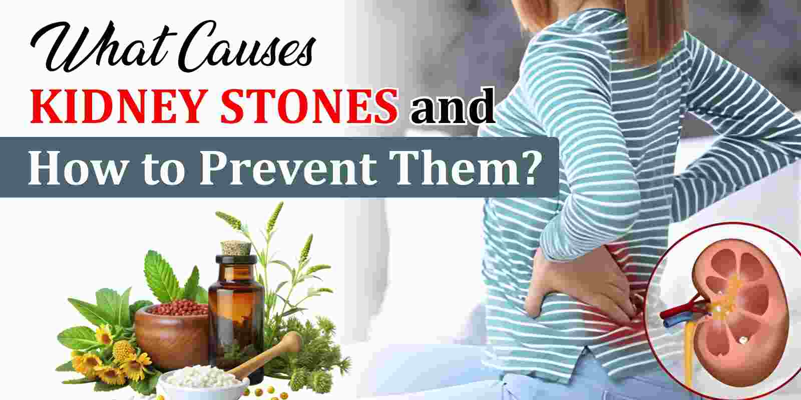 What Causes Kidney Stones and How to Prevent Them?