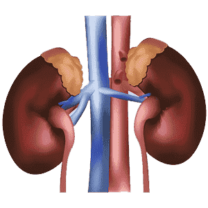 Iga Nephropathy